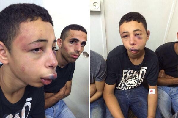 neugodna-situacija-za-izrael-palestinski-djecak-brutalno-prebijen-od-strane-izraelske-policije-je-americki-drzavljanin-iz-floride_3638_5265_e
